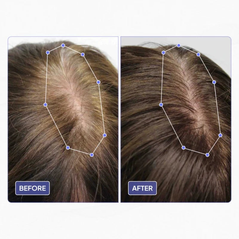 Pure Hair Density Oil