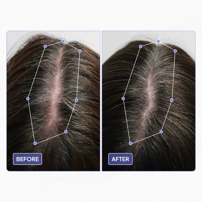 Pure Hair Density Oil