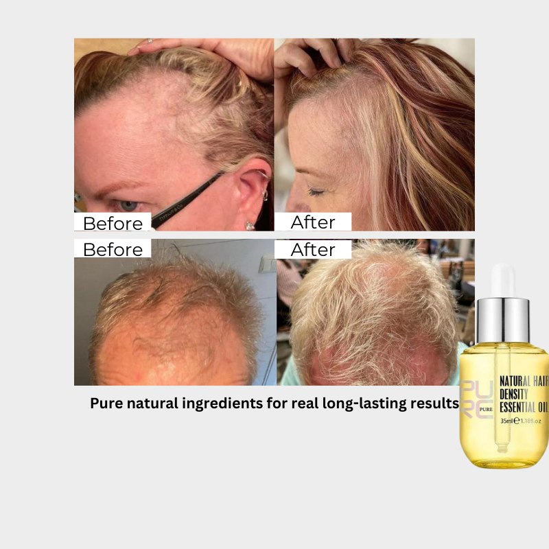 Pure Hair Density Oil